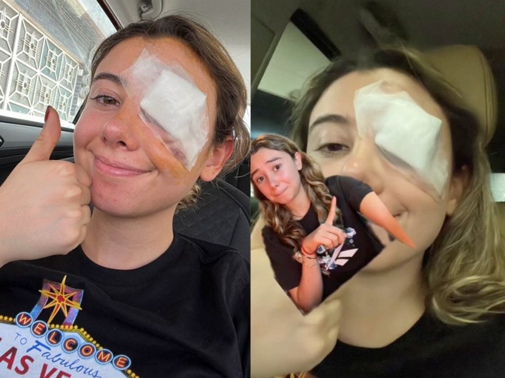 Mujer se somete a cirugía de ojos tras usar un truco de redes sociales para desmaquillarse